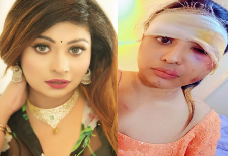 প্রাইভেট কার-মোটরসাইকেল সংঘর্ষ: এখনো চিকিৎসা নিচ্ছেন অভিনেত্রী