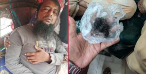 ফেনীতে জামায়াত কর্মীকে পিটিয়ে দাড়ি উপড়ে দেওয়ার অভিযোগ বিএনপি কর্মীদের বিরুদ্ধে