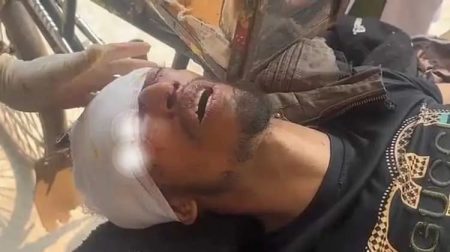 বাগেরহাটে যুবককে কুপিয়ে হাত-পা বিচ্ছিন্ন করলো প্রতিপক্ষরা