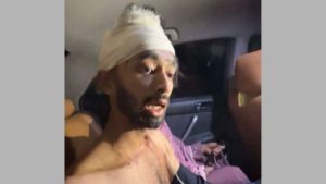 ছাত্রদল কর্মীকে কো পা লো আ.লীগের নেতাকর্মীরা