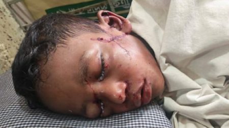 সাভারে শিশুর চোখে সুপার গ্লু ঢেলে নির্যাতনের অভিযোগ